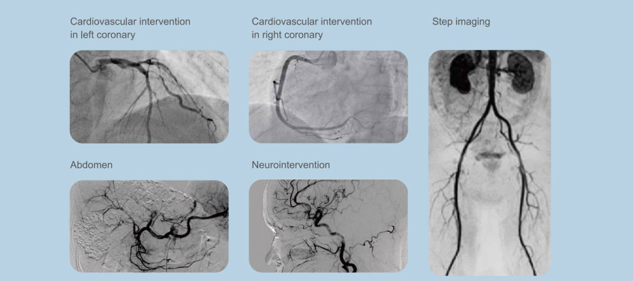 Vicor-CV Robin C/F数字减影血管造影系统