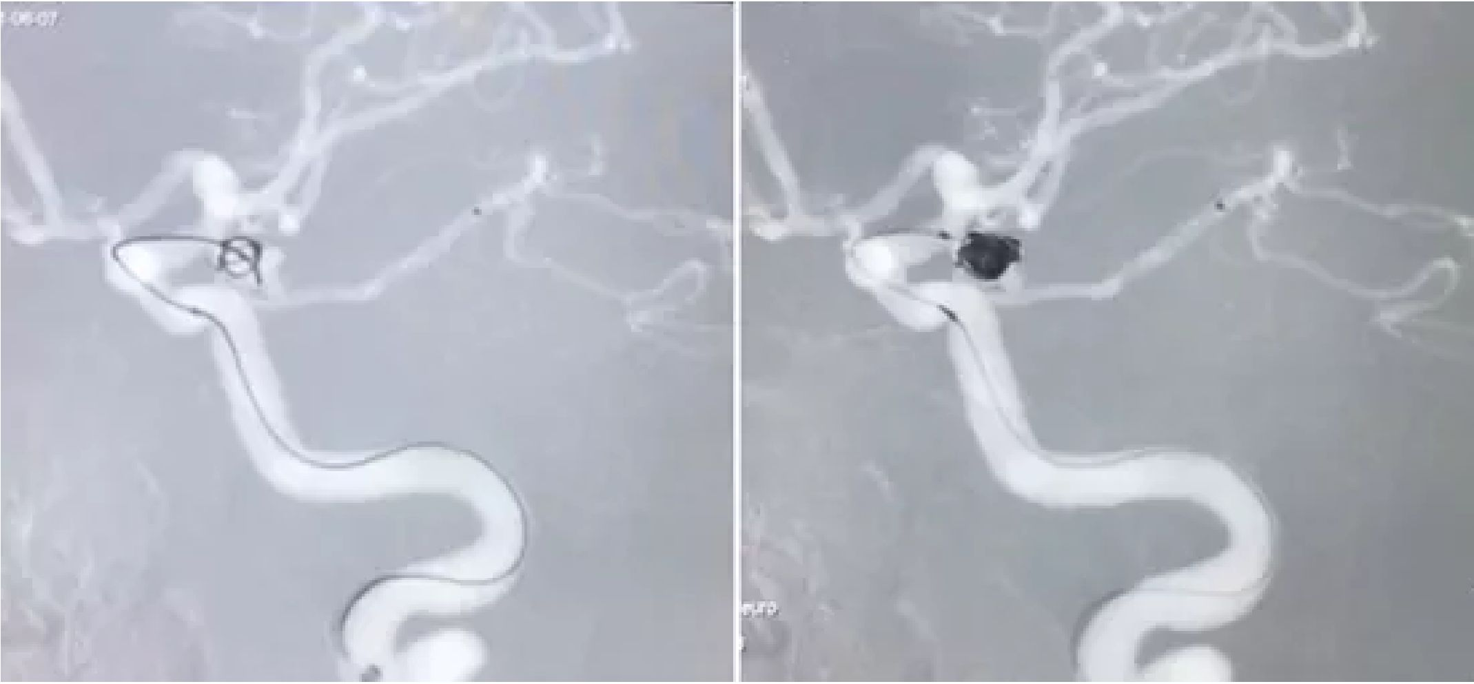 图3.片png