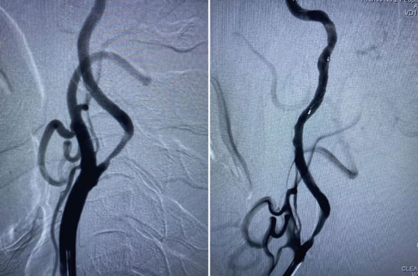 Pre-operative-imaging.jpg